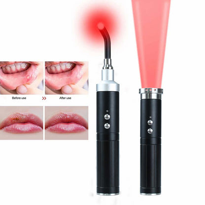 Professional Red Light Infrared Therapy Device Sore Canker Lip Handheld Oral Physiotherapy Wand Ear Nose Knee Health Pain Relief